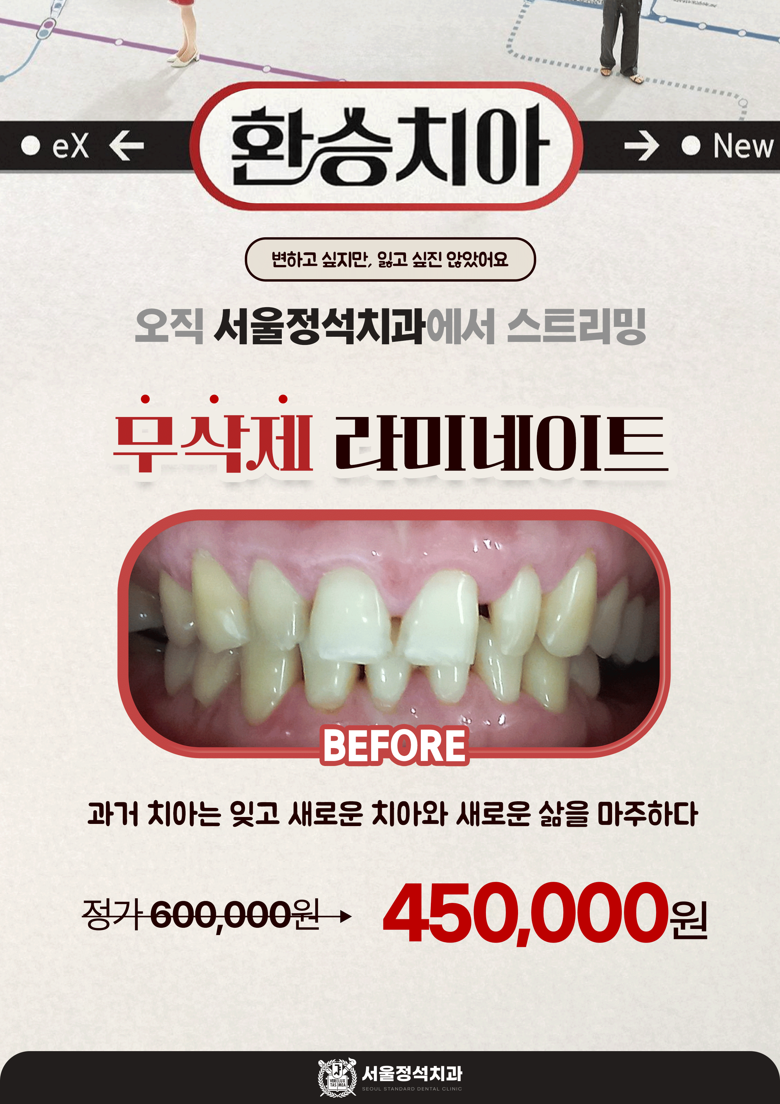 무삭제 라미네이트